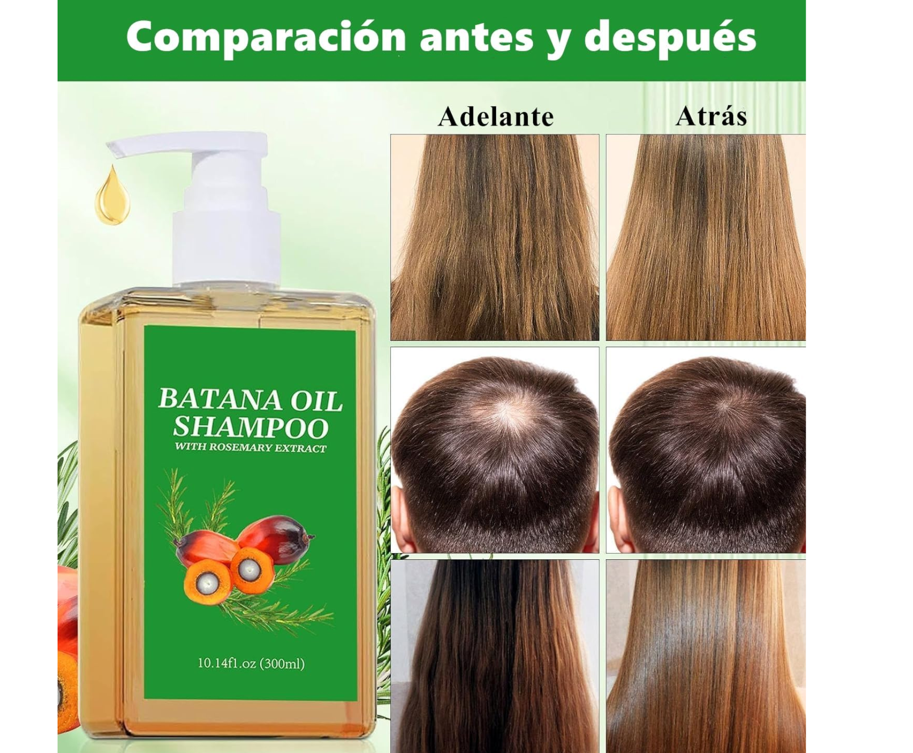 Champú de Batana 100% Natural – Detén la caída y estimula el crecimiento del cabello
