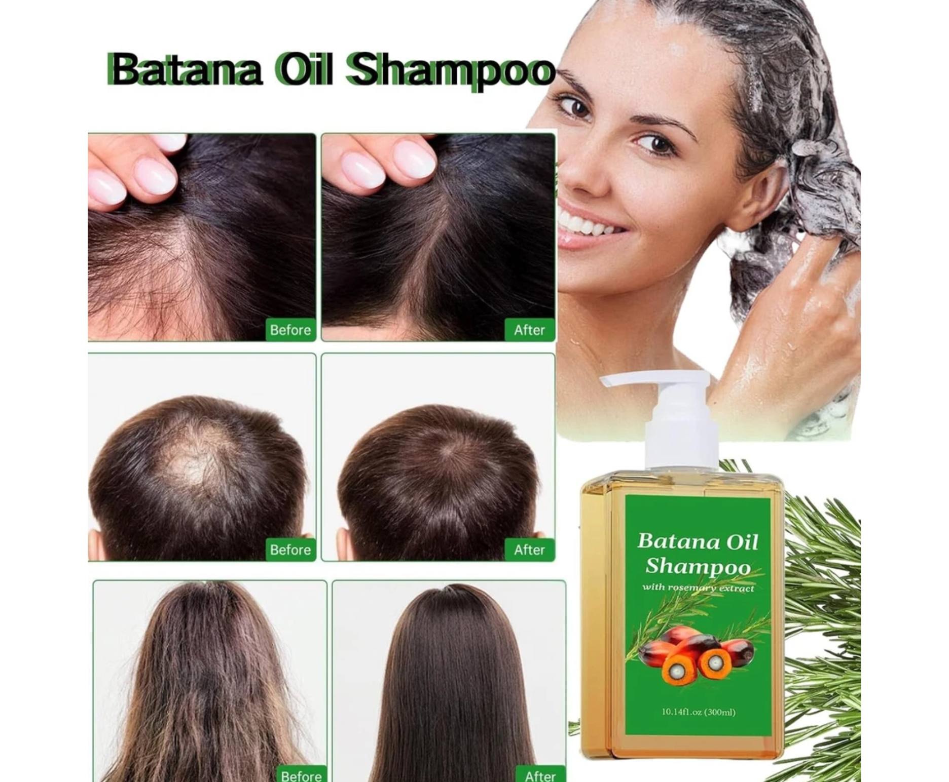 Champú de Batana 100% Natural – Detén la caída y estimula el crecimiento del cabello