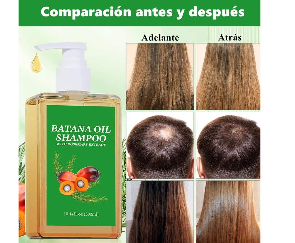 Champú de Batana 100% Natural – Detén la caída y estimula el crecimiento del cabello