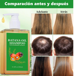 Champú de Batana 100% Natural – Detén la caída y estimula el crecimiento del cabello